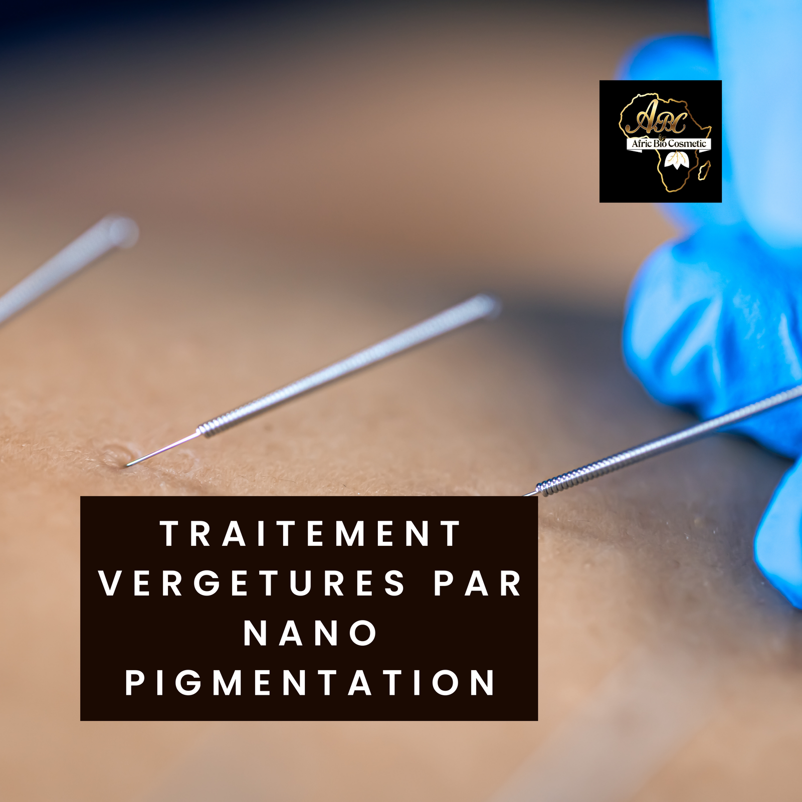 TRAITEMENT VERGETURES PAR NANO PIGMENTATION